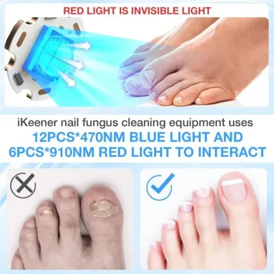 Appareil de soin des ongles des pieds à lumière – image 2