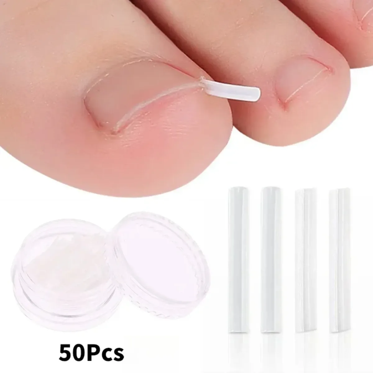 Kit de 50 pièces pour ongles incarnés en plastique