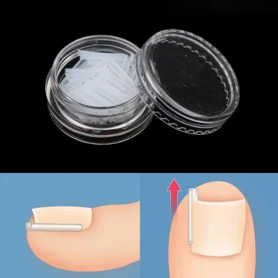 Kit de 50 pièces pour ongles incarnés en plastique – image 3
