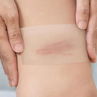 Pansement hydrocolloïde en rouleau, à découper – image 3